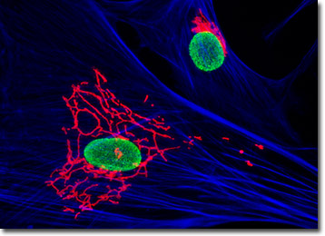 Tahr Ovary Epithelial Cells (HJ1.Ov)