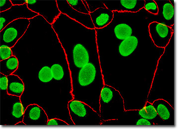 Madin-Darby Canine Kidney Epithelial Cells (MDCK Line)